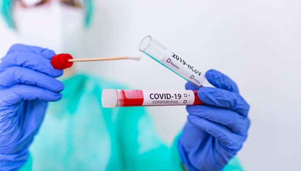 TAMPONE-CORONAVIRUS-COVID-scaled.jpg