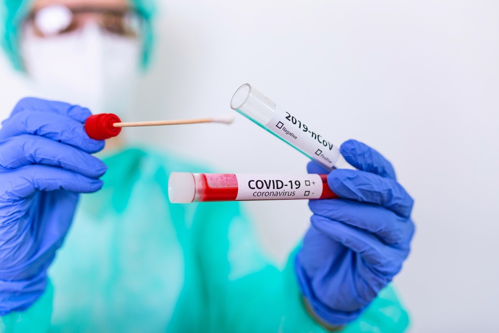 TAMPONE-CORONAVIRUS-COVID-scaled.jpg